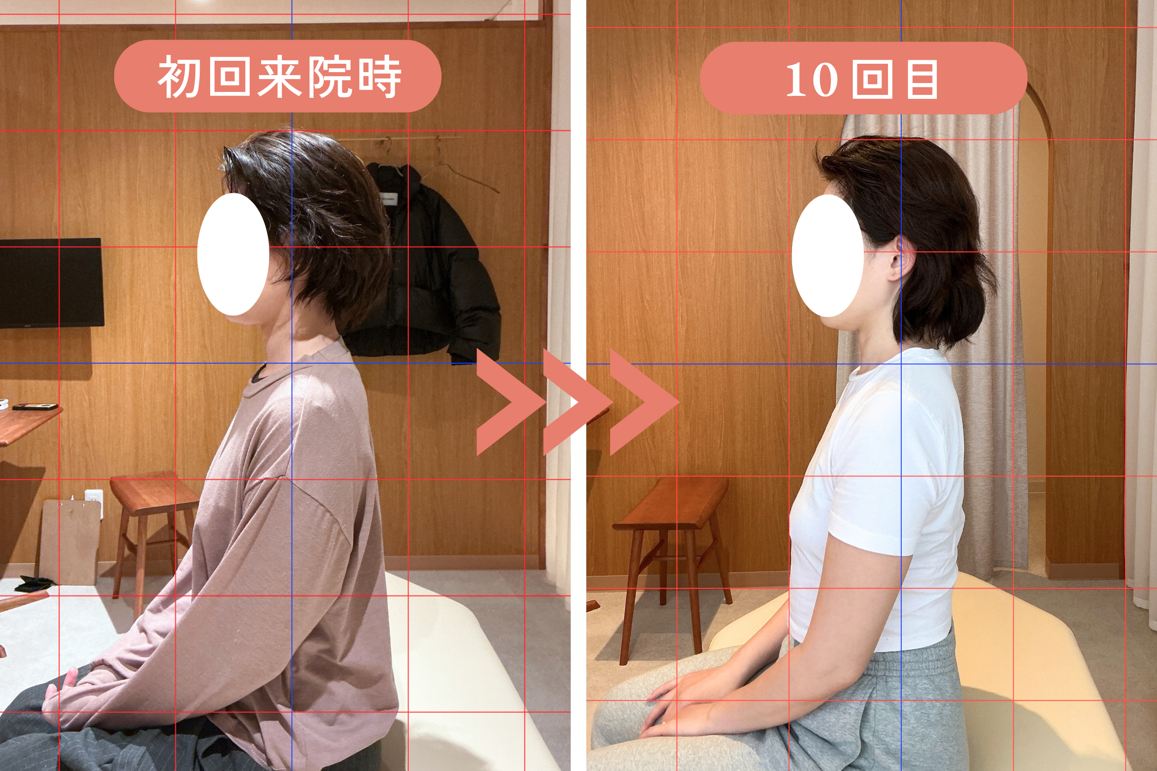 K様 初回時と10回目の姿勢の比較。背中のライン・肩の高さ・全体のバランスが整っている様子