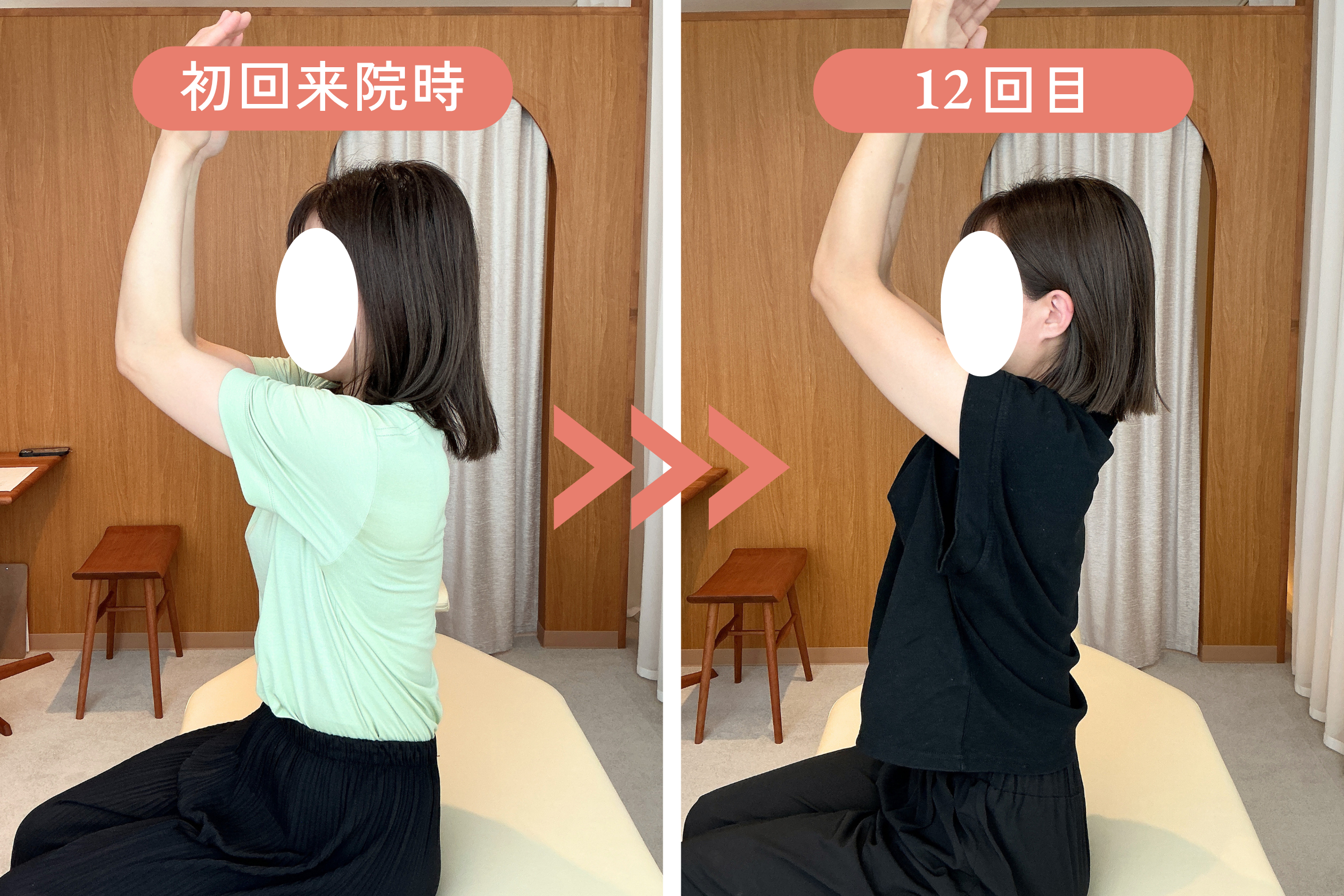 福岡市中央区大手門の動悸めまい 姿勢動作Before/After①｜リリーフポートフェミナ鍼灸整体院 大濠公園店 M様