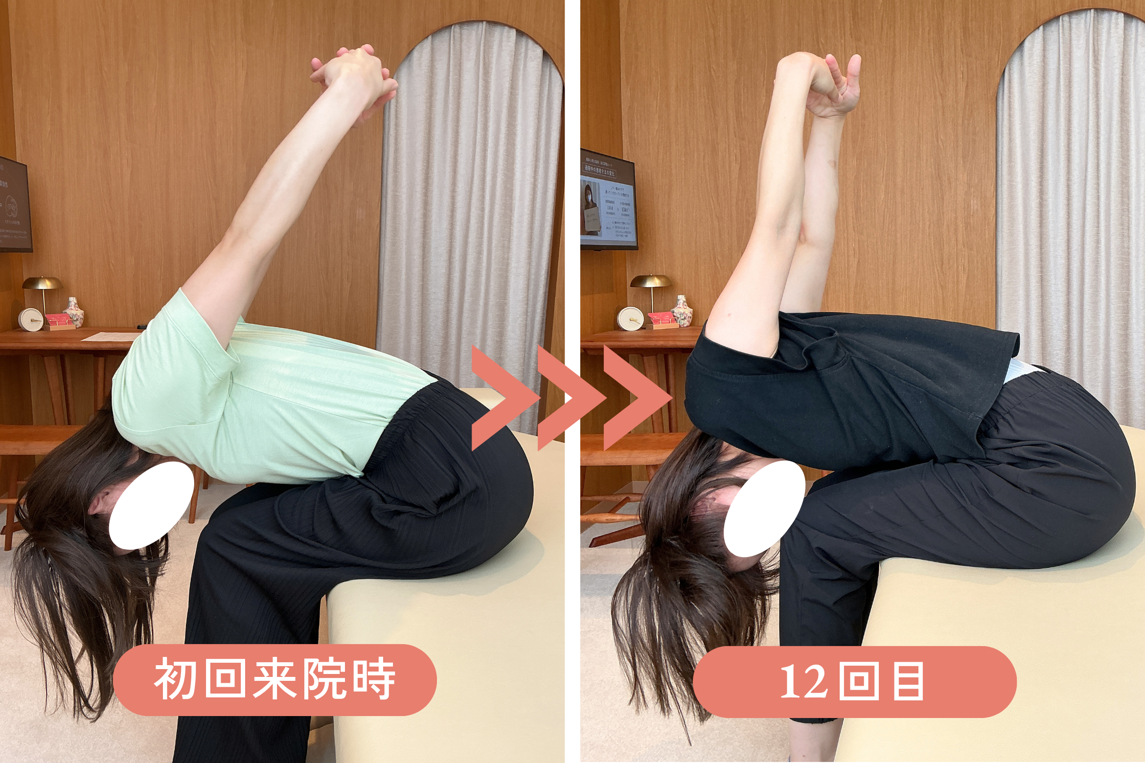 福岡市中央区大手門の動悸めまい 姿勢動作Before/After②｜リリーフポートフェミナ鍼灸整体院 大濠公園店 M様