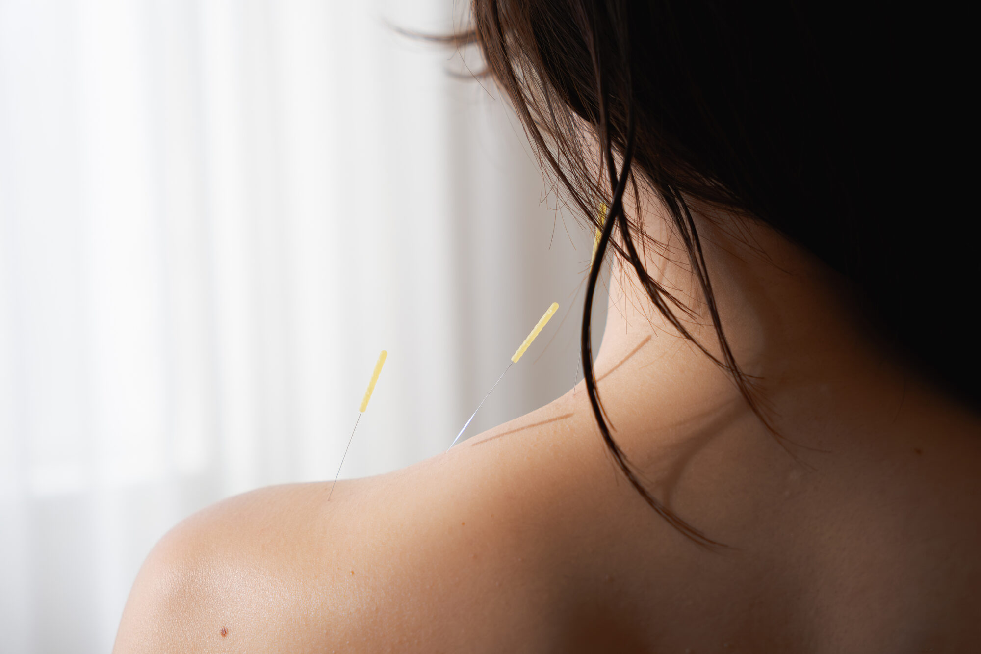 長時間同じ姿勢で起こる肩こり｜姿勢だけではない本当の原因とセルフケア