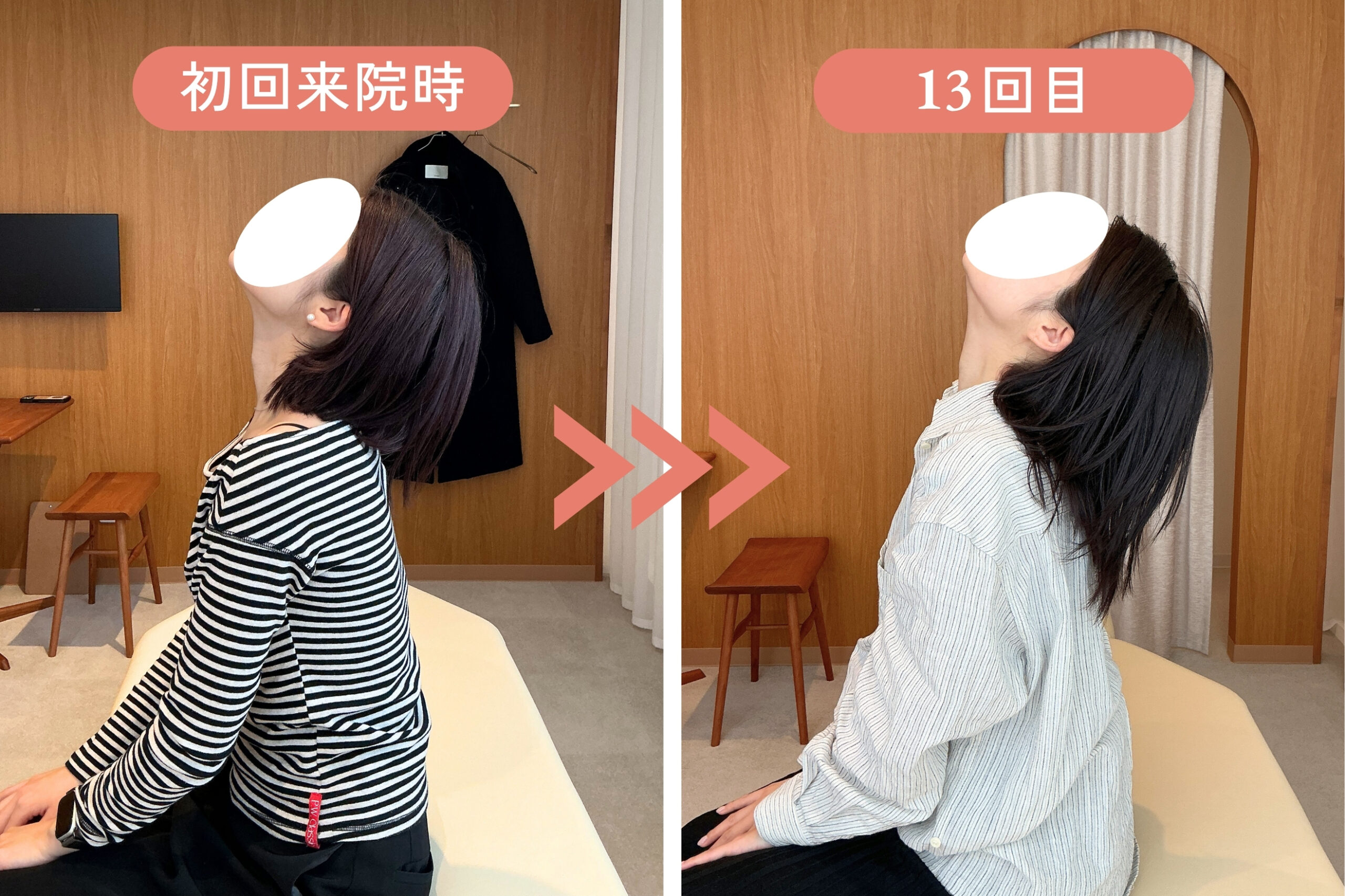 福岡市中央区大手門の慢性腰痛 頸部後屈動作Before/After(矢状面)｜リリーフポートフェミナ鍼灸整体院 大濠公園店 M様
